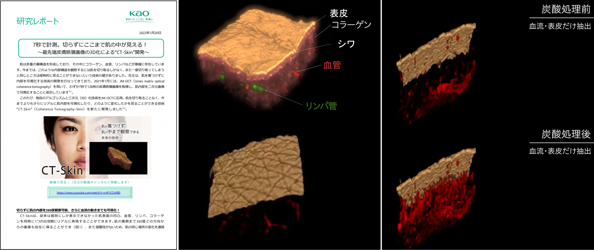JM-OCTの活用事例 : 花王株式会社様 ”CT-Skin” - 株式会社スカイ 