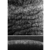 Example of OCT-SD-01 imaging: Human finger