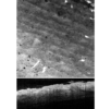 Example of OCT-SS-01 imaging: Human forearm